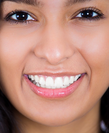 Woman with brilliant smile after teeth whitening
