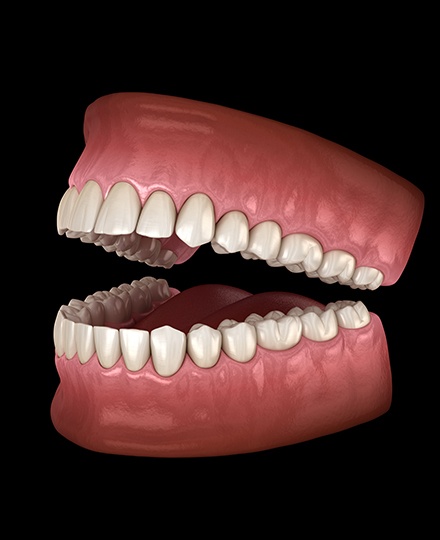 Animated smile with set of dentures