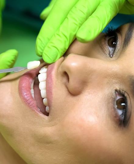 dentist placing a veneer onto a patient’s tooth